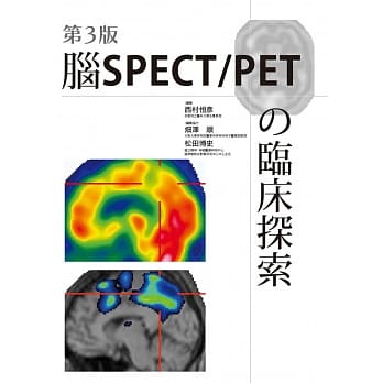 脑SPECT/PETの临床探索(第3版) pdf epub mobi 电子书 下载