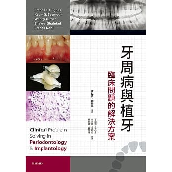 牙周病与植牙：临床问题的解决方案 pdf epub mobi 电子书 下载