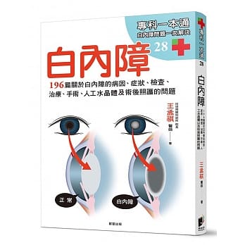 白内障：196篇关于白内障的病因、症状、检查、治疗、手术、人工水晶体以及术后照护的问题 pdf epub mobi 电子书 下载