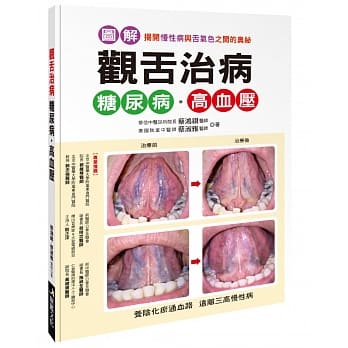 观舌治病 糖尿病．高血压：揭开慢性病与舌气色之间的奥祕 pdf epub mobi 电子书 下载