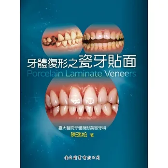 牙體復形之瓷牙貼面 pdf epub mobi 电子书 下载